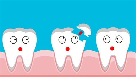 How Much Does It Cost to Fix a Child’s Chipped Tooth?