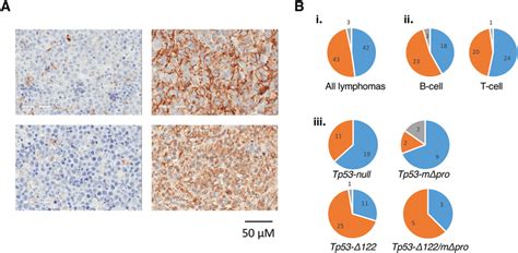 Testin immunohistochemistry of lymphomas. (A) Examples of... | Download ...