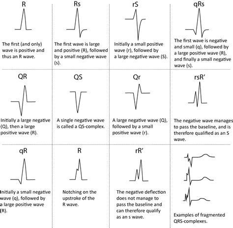 ECG interpretation: Characteristics of the normal ECG (P-wave, QRS complex, ST segment, T-wave ...