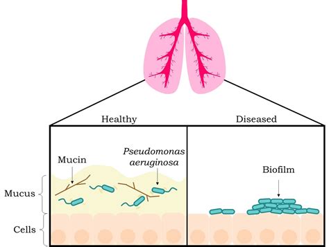 All About That Mucus: How it keeps us healthy - Science in the News