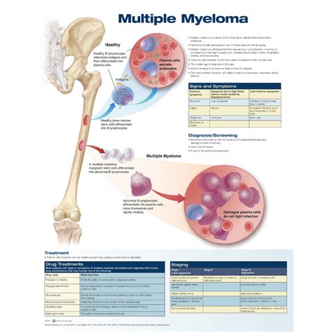 Multiple Myeloma — Medshop New Zealand