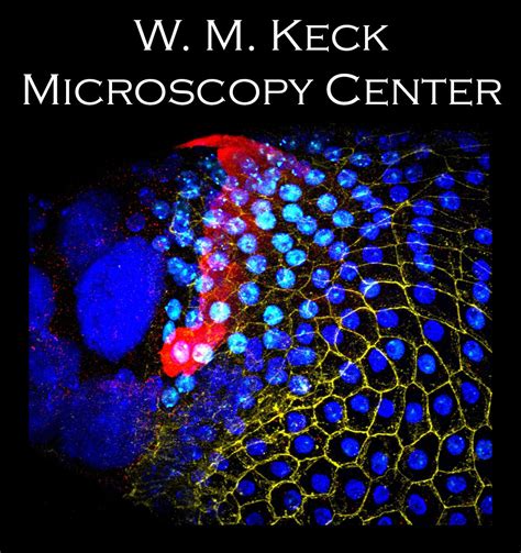 Confocal Microscopy