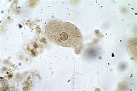 Entamoeba coli – Trophozoite – Parasitology