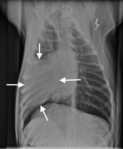 Image Gallery: Primary & Metastatic Tumors Part 1 | Clinician's Brief