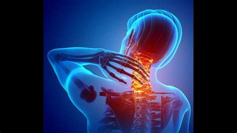 How to get relief from Neck & Cervical Pain - YouTube