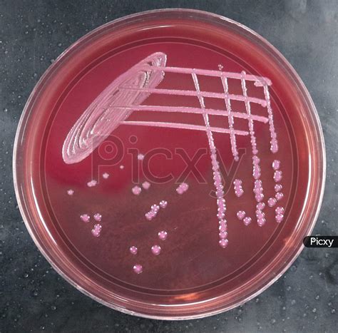 Image of MacConkey agar with lactose fermenting and non lactose fermenting colonies-BR196871-Picxy