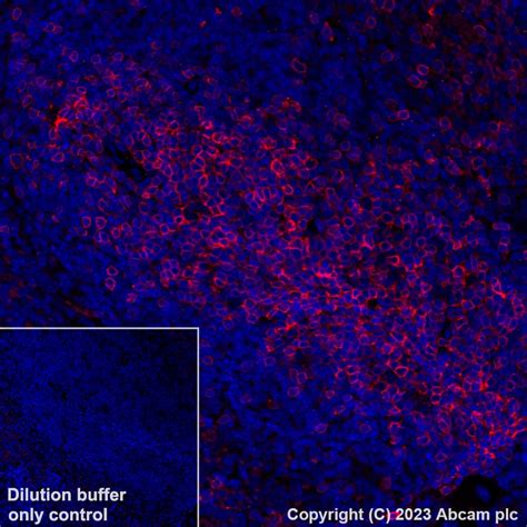 Recombinant Alexa Fluor® 647 Anti-CD5 antibody [EPR26533-75] (ab314468 ...