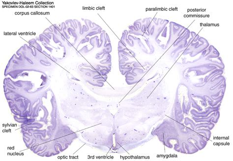 The Dolphin Brain Atlas at Michigan State University