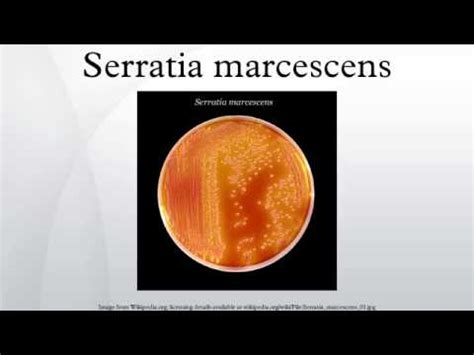 Serratia marcescens - Missy Allred