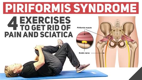 How To Relieve Piriformis Syndrome - Aimsnow7