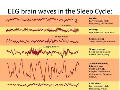 EEG INTERPRETATION | PPT