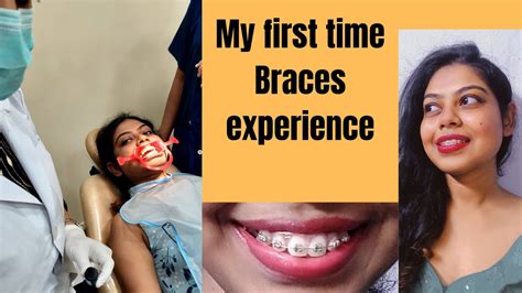 Braces journey.first time braces experience😩 - YouTube