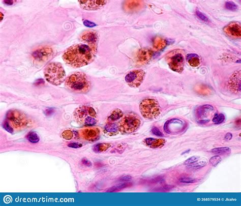 Macrophage Histology