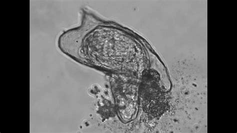 Schistosoma Mansoni Miracidia