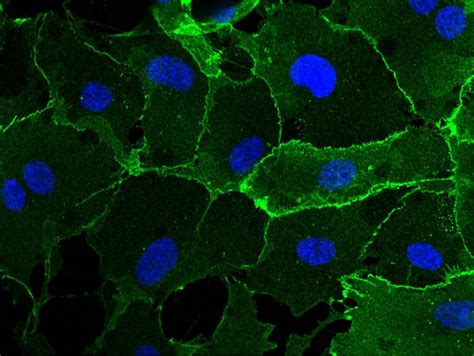 VE-cadherin Antibody (MA5-29141)