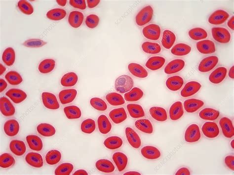 Fish Blood - Stock Image - C004/8744 - Science Photo Library