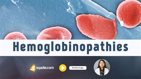 Hemoglobinopathies