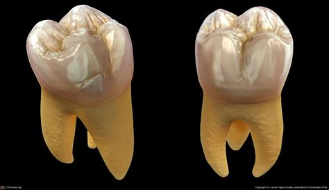 Upper First Molar Anatomy