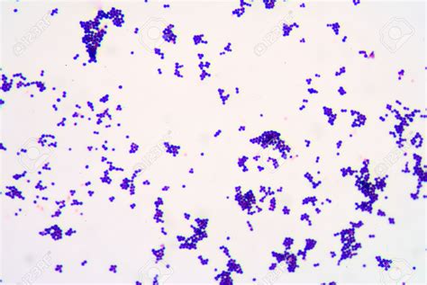 Treating Gram Positive Cocci