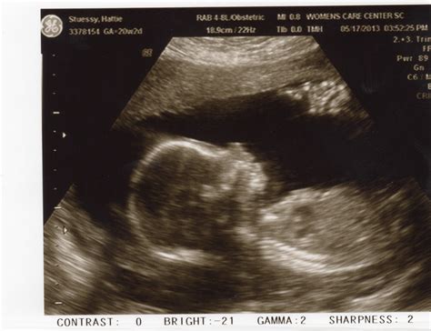 Life of Hattie: Week 22 - It's a baby girl!