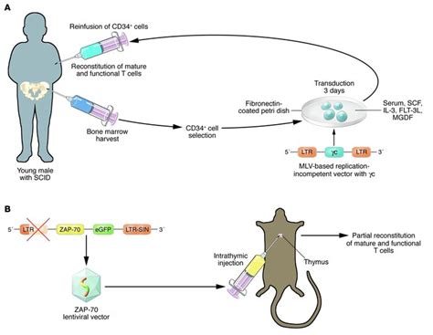 JCI - A new direction for gene therapy: intrathymic T cell–specific lentiviral gene transfer