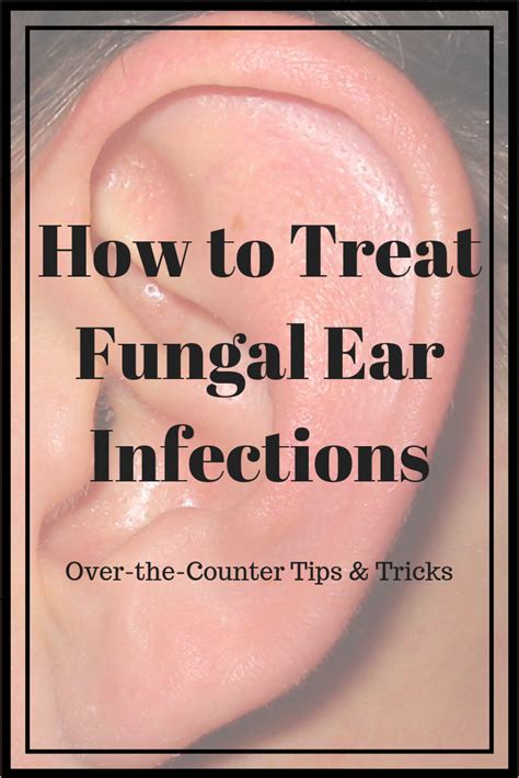 How to Treat Fungal Ear Infections | Ear infection remedy, Ear infection, Swimmers ear remedy