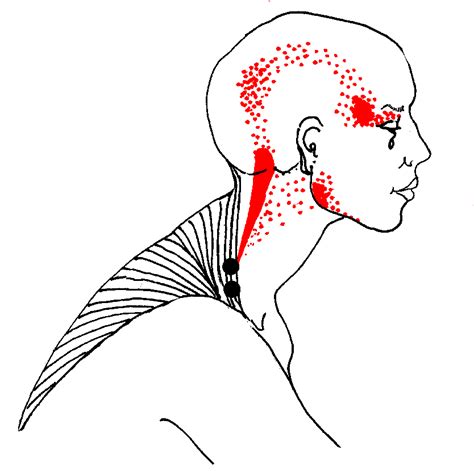 National Association of Myofascial Trigger Point Therapists