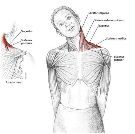 Posture Correction: Neck Stretch and Isometric Exercise - Life in a day ...