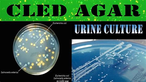 CLED agar media - urine culture/What & Why (clear explanation) - YouTube