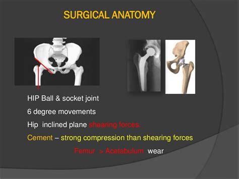 Hip arthroplasty surgical anatomy and approaches