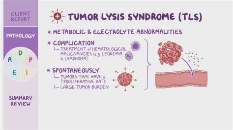 Tumor lysis syndrome (TLS): Nursing Process (ADPIE) - Osmosis Video Library