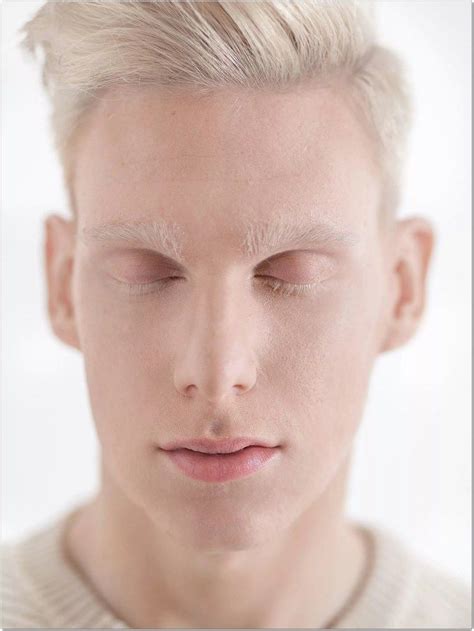 Beautiful and Gorgeous Albino People That Will Make You Speechless 13 | Albino model, Albino men ...
