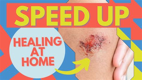 Wound Care! How To Heal Faster At Home - YouTube