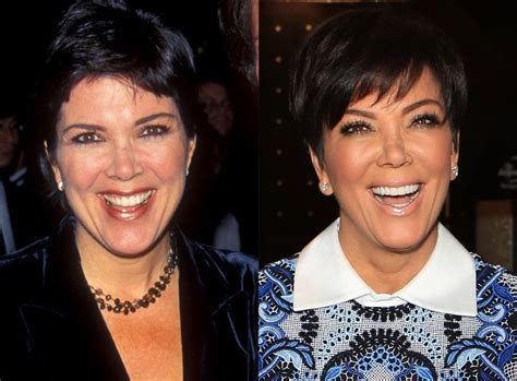 Kris Jenner perfect plastic surgery for 59 years old mother!