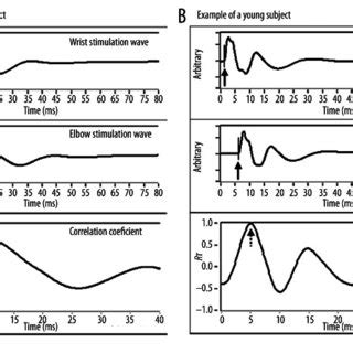 Example of calculating the motor nerve conduction velocity. This figure... | Download Scientific ...