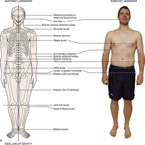 Assessment of Posture | Musculoskeletal Key