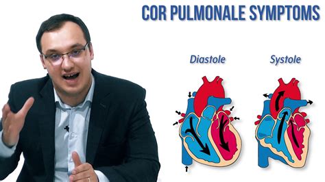 Cor Pulmonale: Symptoms - YouTube