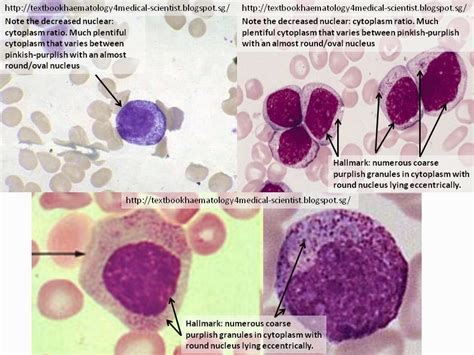 Haematology in a NutShell: Immature Granulocytes in PBFs