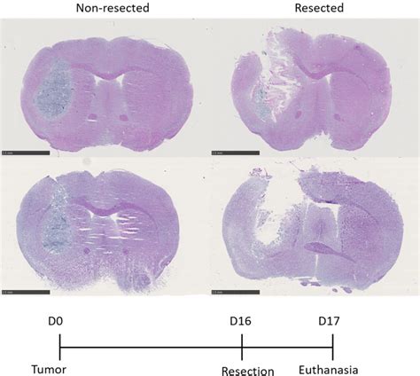 Resection of orthotopic murine brain glioma