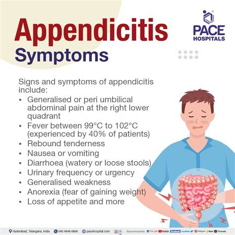 Appendicitis - Symptoms, Types, Causes, Complications, Prevention