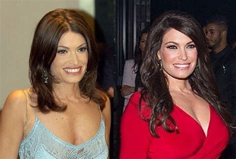 Kimberly Guilfoyle Before And After: A Comprehensive Look At Her ...