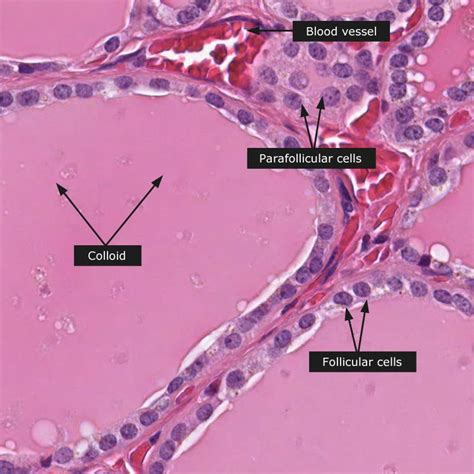 Thyroid Gland Dictionary