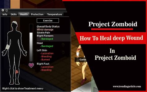 Fix project zomboid laceration Problem - Official Working Tricks : r/projectzomboid