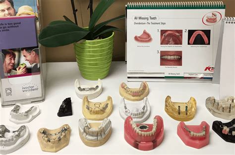 Steps to Your New Dentures