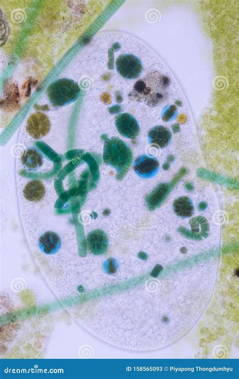 Frontonia Sp. Unicellular Ciliate Protists Under the Microscope. Stock Image - Image of members ...