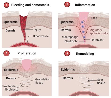 Stages of the wound healing cascade. Created by using BioRender.com ...