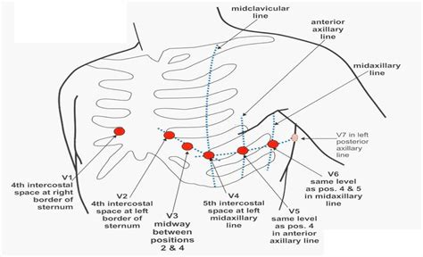 precordial-leads - Cardiac Sciences Manitoba