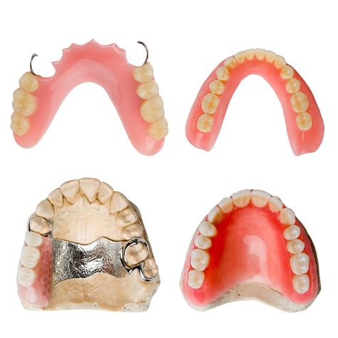 Upper Partial Denture