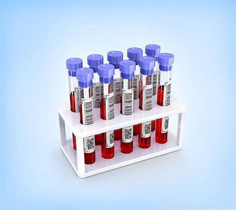 Blood Vials Stock Photos, Pictures & Royalty-Free Images - iStock