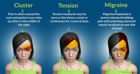 What's The Difference Between Headaches And Migraines? Here's How To ...